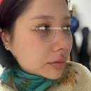 새오약국 | 시골쥐 서울까지 가서 코 수술하고 오다! <내돈내산 비염수술 기능코,자가늑> ~16일차 후기