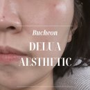 씨유부천진달래마을점 | 상동역 피부관리 탄력·속건조 고민 해결｜진달래마을 델루아 에스테틱 후기