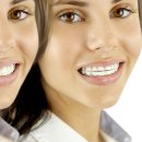 클리어치과기공소 이미지