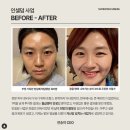 인셀덤 승리