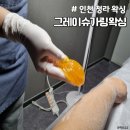 인천 청라 왁싱 : 그레이슈가링왁싱 청라점 예신관리 받고왔어요 !