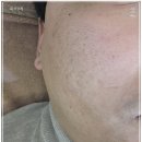 백송종합세탁 | 부산 피부관리 모공 고민된다면 동래 올리다 에스테틱 피부모공센터 부산점 방문 후기
