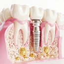 일산웰치과의원 이미지