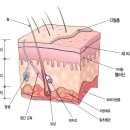 피부,피부병,습진,아토피,2차감염 이미지