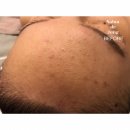 하이엘 PC | 바이오필/인계동 피부관리 살롱드정에서 바이오필 내돈내산으로 찐 피부미인 완성!(Feat.살롱드정 후기)