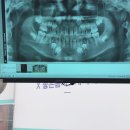 미소더예쁨치과의원 이미지