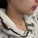 (주)디에프브이투 | 신논현역 ㄹㅁ성형외과 이중턱살제거 근육묶기 투턱없애기 한달 솔직 후기