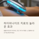 희망하이퍼 | # 하이퍼나이프 치료 후기: 정말 효과 있을까? 직접 받아본 솔직 후기!