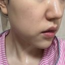 등드름클렌져는 &#39;세타필 각질제거 SA 클렌저&#39;로! 가격, 후기까지!