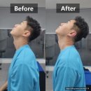 21세기종합센타 | 영등포 스트레치뱅 당산점 후기｜거북목과 어깨뭉침, 혼자 하는 스트레칭의 한계를 느꼈을 때