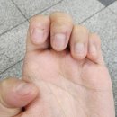 [W] 강남 압구정 웨딩네일 물어뜯는 손톱 연장 후기 : LCN라운지 강남압구정점 이홍진뷰티