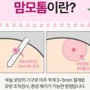 춘의역 | 춘의역외과추천, 맘모톰수술후기 확인!