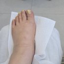 평택농업협동조합 | 평택내성발톱, 평택무좀, 독일식 푸스케어 평택고덕점 전문 케어 받고온 후기