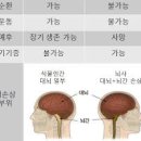 뇌사상태 식물인간 차이점 뜻 뇌사판정 회복 간략정리 이미지