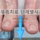 리솜사랑의원 네이버블로그