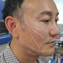 카이로스성형크리닉 네이버블로그