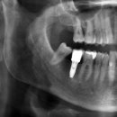 서울수려한치과병원 이미지