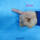 강남챔피언정형외과의원 이미지