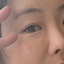 리즈백스킨