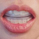 덴탈스페이스 이미지