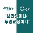 천안중앙플란트치과 | 배방역 치아교정 | 브라켓이냐 투명교정이냐, 결국 답은 의사의 설계력에 있었습니다
