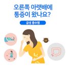 맹장염 초기 증상 통증 위치 진단 이미지