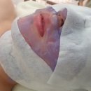 예쁜여우피부관리 이미지