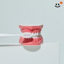 임플란트 치료 후 식사는 어떻게 해야 하나요?