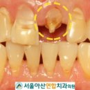 심미연합치과의원 네이버블로그