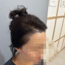 S헤어라인