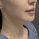 [일상글] 부천 상동 피부관리 웨딩수기관리 전문샵 “가인미가” 다녀온 후기