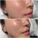 건대에스테틱 고에비아뷰티 비비글로우 세라링 조합으로 꿀광피부 관리하고 온 후기