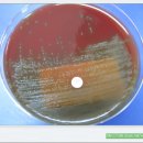 Streptococcus spp(Optochin test)음성의 성상 이미지