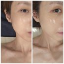 다산피부관리 더블제이뷰티 물방울리프팅 후기