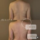 (주)케어핏 | 드레스 라인을 완성하는 ‘웨딩핏 케어’ 리얼 후기 &amp; 관리 TIP 오늘하루쉼표 부산 서면 부전 에스테틱