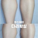 뚠스뷰티 네이버블로그