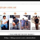 멍친 이미지