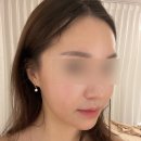 마곡 피부관리 프리미엄 에스테틱 보떼벨르 웨딩 예신관리