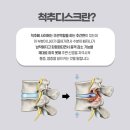 척추가중심