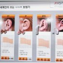 독일디지털보청기 이미지
