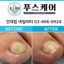 네일비타&푸스케어(건대점) 네이버블로그