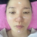 동탄케어 | 동탄 에스테틱 피부/체형관리 ‘다올뷰티 동탄점’ 프리미엄 케어 후기