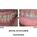 디자인치과기공소(DESIGN) 이미지