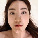 리젠에스테틱 - 김해시 | 용산에스테틱 1회차만으로 달라진 여드름성피부 더맑은스킨 리젠필 후기