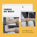바이오메디 이루 | 팔뚝 지방흡입후 바본 관리받으신 김♡성 고객님 후기[대구 바디관리연구소]