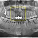 바른뿌리치과의원 이미지
