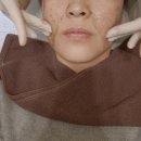 분당-2 | 분당여드름자국 율각테라피 내돈내산 2회차 후기