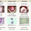 질염검사[Vaginitis test] 이미지