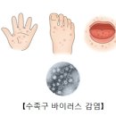 5월 건강안내 이미지