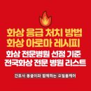 화상 응급 처치 방법, 화상 오일 레시피, 화상 전문병원 기준, 전국 화상 전문 병원 리스트